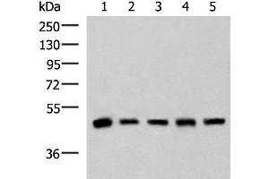 Western blot analysis of Human fetal liver tissue HepG2 A172 Hela and Jurkat cell lysates using PCYT2 Polyclonal Antibody at dilution of 1:800