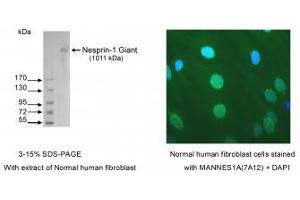 Image no. 1 for anti-Spectrin Repeat Containing, Nuclear Envelope 1 (SYNE1) antibody (ABIN1042627) (SYNE1 antibody)