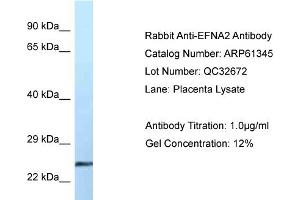 Western Blotting (WB) image for anti-Ephrin A2 (EFNA2) (Middle Region) antibody (ABIN2788773) (Ephrin A2 antibody  (Middle Region))