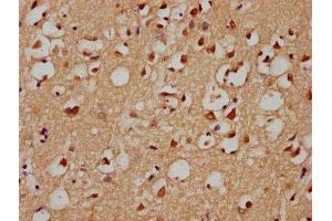 IHC image of ABIN7154372 diluted at 1:300 and staining in paraffin-embedded human brain tissue performed on a Leica BondTM system. (GRHL1 antibody  (AA 1-95))