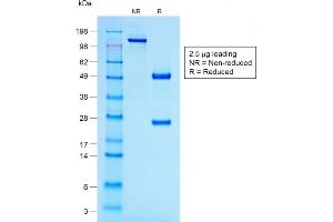 SDS-PAGE Analysis Purified ACTH Mouse Recombinant Monoclonal Antibody (r57). (Recombinant POMC antibody  (N-Term))