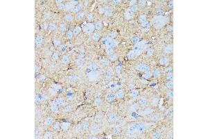 Immunohistochemistry of paraffin-embedded mouse brain using Versican Rabbit mAb (ABIN7271309) at dilution of 1:100 (40x lens). (Versican antibody)