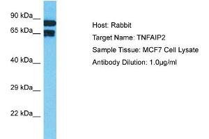 Host: Rabbit Target Name: TNFAIP2 Sample Tissue: Human MCF7 Whole Cell Antibody Dilution: 1ug/ml
