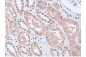 IHC-P analysis of Human Kidney Tissue, with DAB staining. (STIP1 antibody  (AA 1-169))