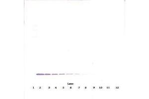 anti-Colony Stimulating Factor 2 (Granulocyte-Macrophage) (CSF2) antibody