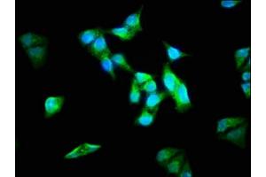 Immunofluorescence staining of Hela cells with ABIN7143957 at 1:133, counter-stained with DAPI.