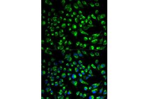Immunofluorescence analysis of HeLa cell using SPAM1 antibody. (SPAM1 antibody  (AA 100-300))