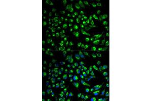 Immunofluorescence analysis of HeLa cell using SPAM1 antibody.
