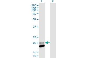 Western Blot analysis of IFNA13 expression in transfected 293T cell line by IFNA13 MaxPab polyclonal antibody.