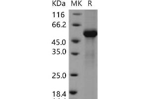 Tissue Factor Pathway Inhibitor 2 (TFPI2) protein (Fc Tag)