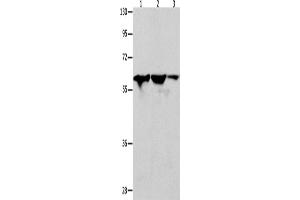Western Blotting (WB) image for anti-DnaJ (Hsp40) Homolog, Subfamily C, Member 7 (DNAJC7) antibody (ABIN2428528) (DNAJC7 antibody)