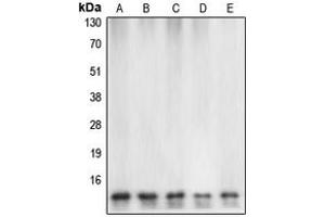Western blot analysis of Caspase 7 expression in HeLa (A), mouse heart (B), rat heart (C), Jurkat etoposid-treated (D), HEK293T (E) whole cell lysates. (Caspase 7 antibody  (Center))