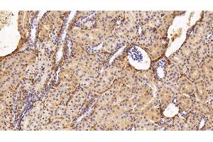 Detection of PIIINP in Human Kidney Tissue using Monoclonal Antibody to Procollagen III N-Terminal Propeptide (PIIINP) (PIIINP antibody)
