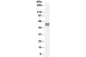 Western blot testing of human bone marrow lysate with CACNB4 antibody at 0. (CACNB4 antibody)