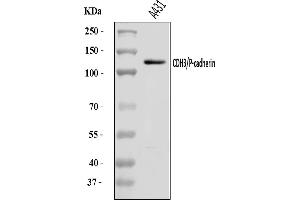 Western blot analysis of P Cadherin/CDH3 using anti-P Cadherin/CDH3 antibody (ABIN7600789).