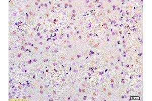 Formalin-fixed and paraffin embedded rat brain labeled with Anti-CHMP4B/CHMP4C Polyclonal Antibody, Unconjugated (ABIN872575) at 1:200 followed by conjugation to the secondary antibody and DAB staining. (CHMP4B antibody  (AA 101-200))