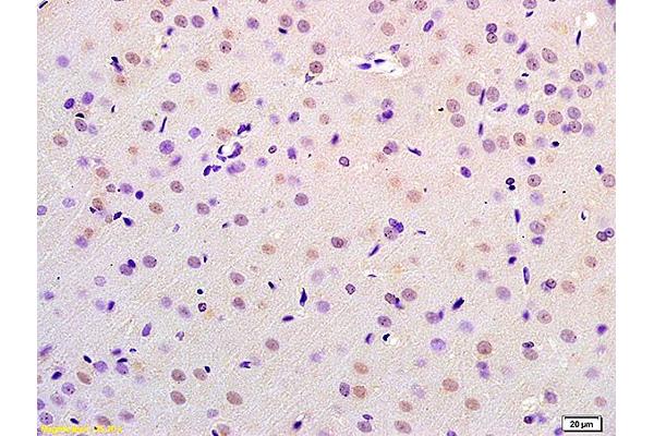 CHMP4B antibody  (AA 101-200)