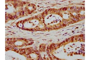 Histone H1.5 antibody  (AA 14-25)