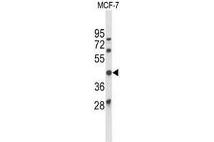 Western blot analysis of ATXN3 Antibody (Center) in MCF-7 cell line lysates (35µg/lane). (Ataxin 3 antibody  (Middle Region))