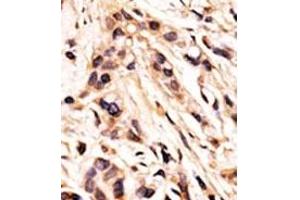 Image no. 2 for anti-Retinoblastoma 1 (RB1) (pSer608) antibody (ABIN358211) (Retinoblastoma 1 antibody  (pSer608))