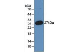Detection of Recombinant PMP22, Human using Monoclonal Antibody to Peripheral Myelin Protein 22 (PMP22)