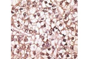 Immunohistochemistry (IHC) image for anti-ATP-Binding Cassette, Sub-Family B (MDR/TAP), Member 4 (ABCB4) (AA 624-654) antibody (ABIN3030051)