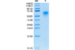 Canine CD46 on Tris-Bis PAGE under reduced condition. (CD46 Protein (CD46) (AA 45-344) (His tag))