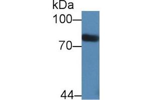 Detection of STAT3 in Rat Serum using Polyclonal Antibody to Signal Transducer And Activator Of Transcription 3 (STAT3)