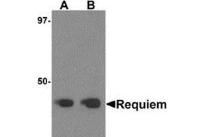 Western blot analysis of Requiem in mouse kidney tissue lysate with Requiem antibody at 1 μg/ml.