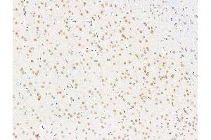 ABIN7094825 and ABIN7098876 at 1/100 staining Rat brain tissue by IHC-P.