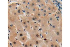 Used in DAB staining on fromalin fixed paraffin-embedded liver tissue (SGK2 antibody  (AA 40-311))