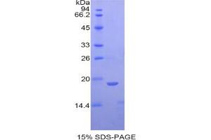 SDS-PAGE analysis of Rat Fibrillin 1 Protein. (Fibrillin 1 Protein (FBN1))
