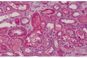 Human Kidney: Formalin-Fixed, Paraffin-Embedded (FFPE) (MAD2L1 antibody  (AA 1-174))