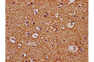 IHC image of ABIN7167153 diluted at 1:200 and staining in paraffin-embedded human brain tissue performed on a Leica BondTM system. (RASAL2 antibody  (AA 749-835))