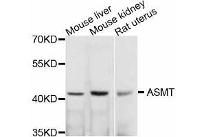 Western blot analysis of extracts of various cell lines, using ASMT antibody (ABIN5999240) at 1/1000 dilution. (ASMT antibody)