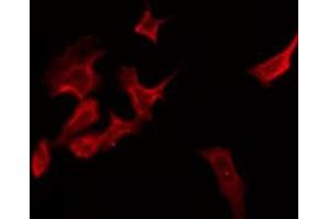 ABIN6275876 staining Hela by IF/ICC. (BTLA antibody  (C-Term))