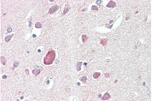 ABIN5539880 (5µg/ml) staining of paraffin embedded Human Cortex. (PTGDS antibody  (Internal Region))