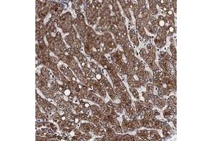 Immunohistochemical staining of human liver with VPS37D polyclonal antibody  shows strong cytoplasmic positivity in hepatocytes.