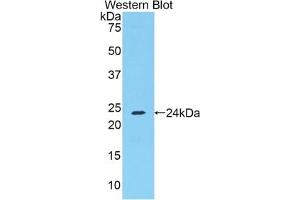 Detection of Recombinant FGA, Mouse using Polyclonal Antibody to Fibrinogen Alpha Chain (FGA) (FGA antibody  (AA 357-556))