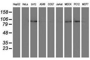 Image no. 3 for anti-Dipeptidyl-Peptidase 8 (DPP8) antibody (ABIN1497835) (DPP8 antibody)
