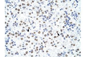 HNRPD antibody was used for immunohistochemistry at a concentration of 4-8 ug/ml to stain Hepatocytes (arrows) in Human Liver. (HNRNPD/AUF1 antibody)