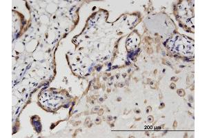 Immunoperoxidase of monoclonal antibody to SIK1 on formalin-fixed paraffin-embedded human placenta. (SIK1 antibody  (AA 1-100))