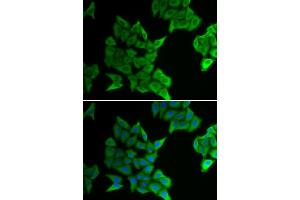 Immunofluorescence analysis of HeLa cells using GJA5 antibody. (Cx40/GJA5 antibody)