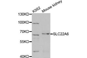 Western Blotting (WB) image for anti-Solute Carrier Family 22 Member 6 (SLC22A6) antibody (ABIN1876924) (SLC22A6 antibody)