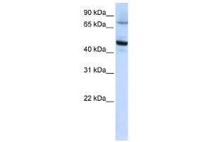 WB Suggested Anti-CYP46A1 Antibody Titration:  0. (CYP46A1 antibody  (C-Term))