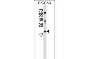 LIN52 Antibody (N-term ) (ABIN657405 and ABIN2846445) western blot analysis in SK-BR-3 cell line lysates (35 μg/lane). (LIN52 antibody  (N-Term))