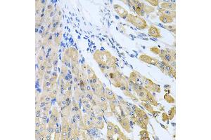 Immunohistochemistry of paraffin-embedded mouse stomach using CASP9 antibody (ABIN5997370) at dilution of 1/100 (40x lens). (Caspase 9 antibody)