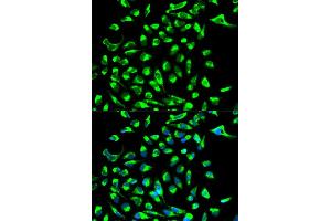 Immunofluorescence analysis of MCF-7 cell using CLDN7 antibody. (Claudin 7 antibody  (AA 29-211))
