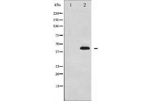 Western blot analysis of p38 MAPK phosphorylation expression in Jurkat whole cell lysates,The lane on the left is treated with the antigen-specific peptide. (MAPK14 antibody  (pTyr323))