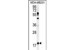 RHEB Antibody (C-term) (ABIN655712 and ABIN2845163) western blot analysis in MDA-M cell line lysates (35 μg/lane). (RHEB antibody  (C-Term))